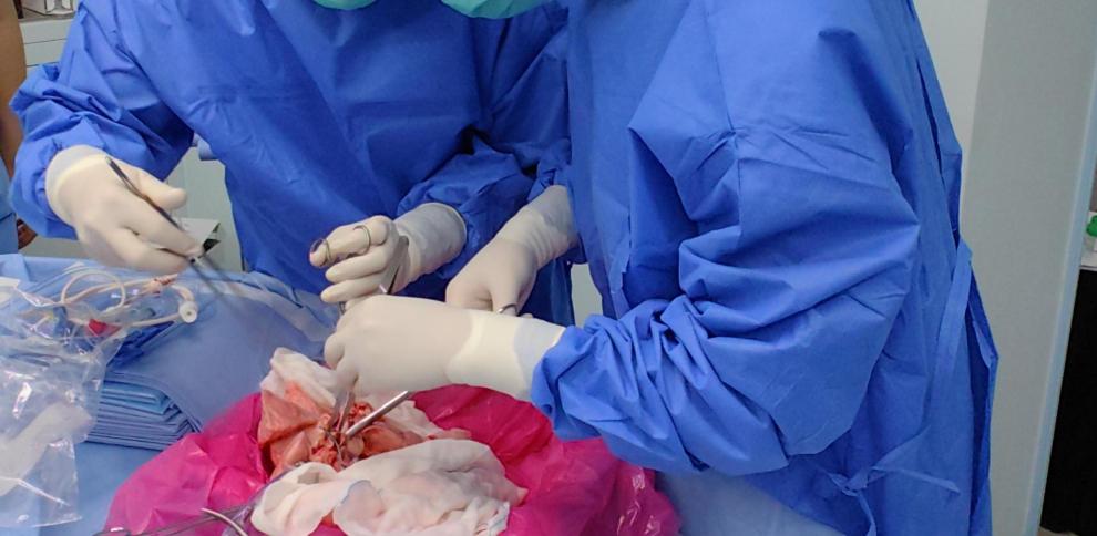 En China: Realizan el primer trasplante de pulmón de cerdo a un humano con muerte cerebral