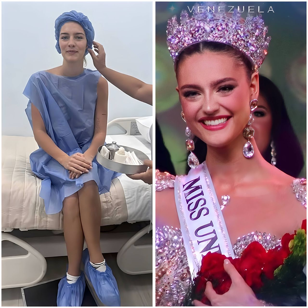 Miss Venezuela 2025 Clara Vegas Goetz se sometió a cirugía estética para aumentar su busto