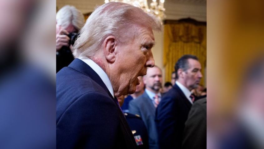 El sarpullido en el cuello de Trump reavivan el debate sobre su salud: Su médico explica que se debe a un 